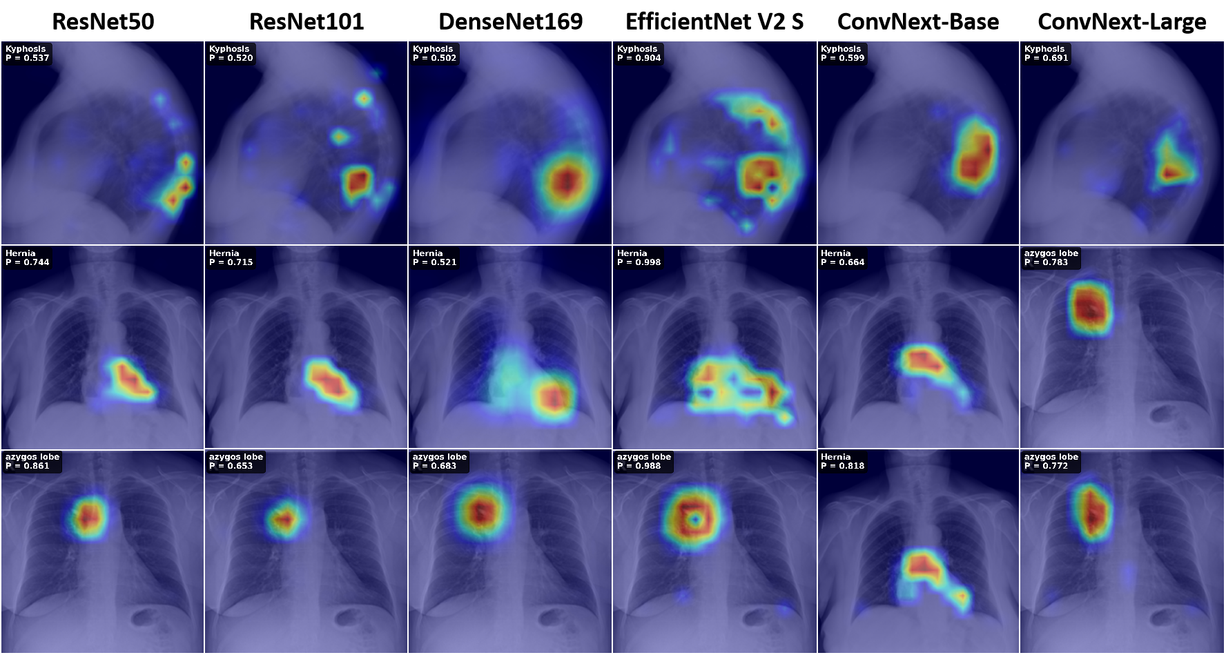 Class activation maps on CXR images