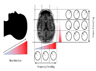 Alzheimer's survey paper thumbnail