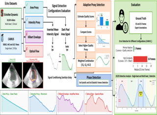 ECG Free Cardiac Timing in Echo paper thumbnail