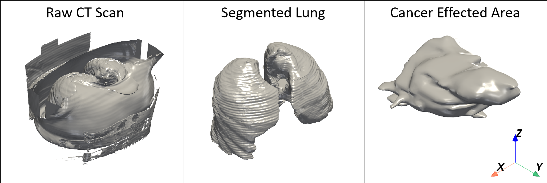 Lung Cancer CT Input Data