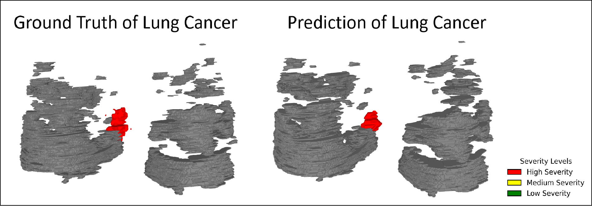 Lung Cancer 3D Prediction