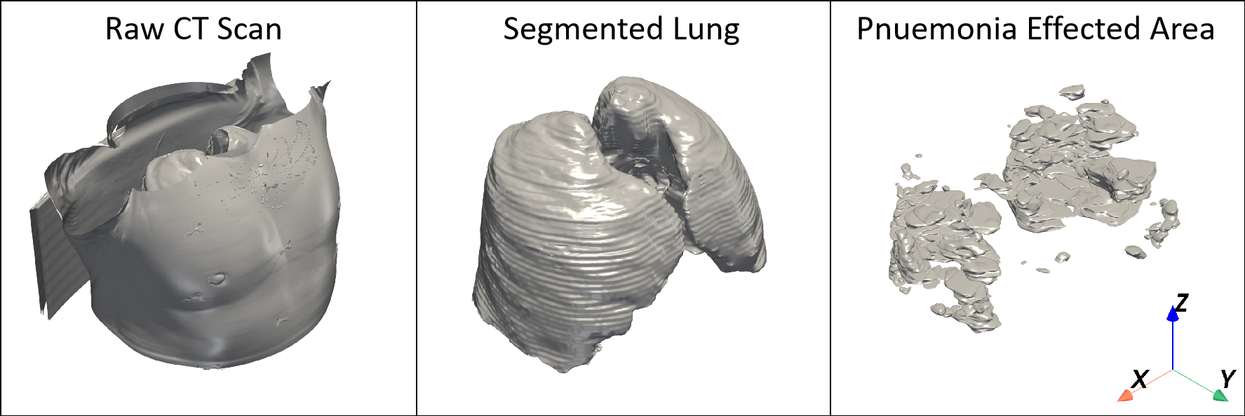 COVID-19 CT Input Data