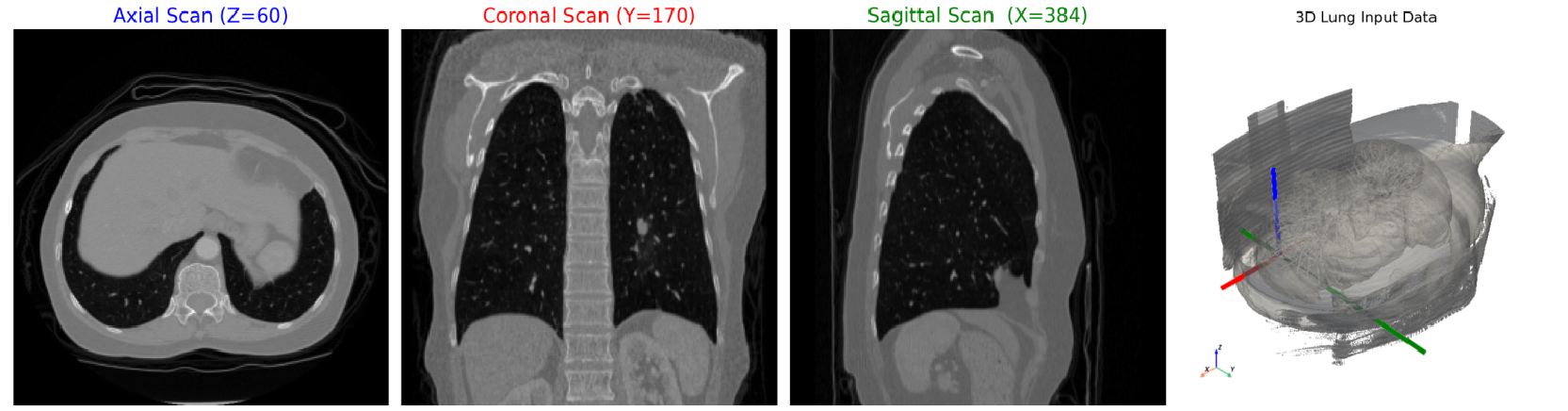 Axial Coronal Sagittal Views